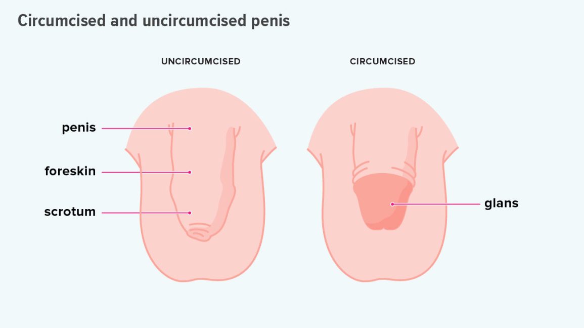 Phimosis & Paraphimosis-By Circumcision Clinic